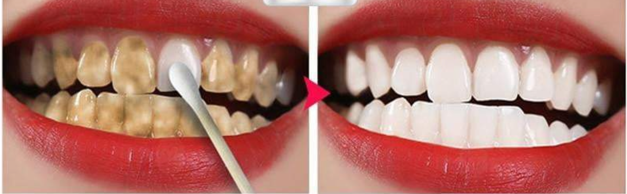 Teeth Whitening Oral Hygiene Essence