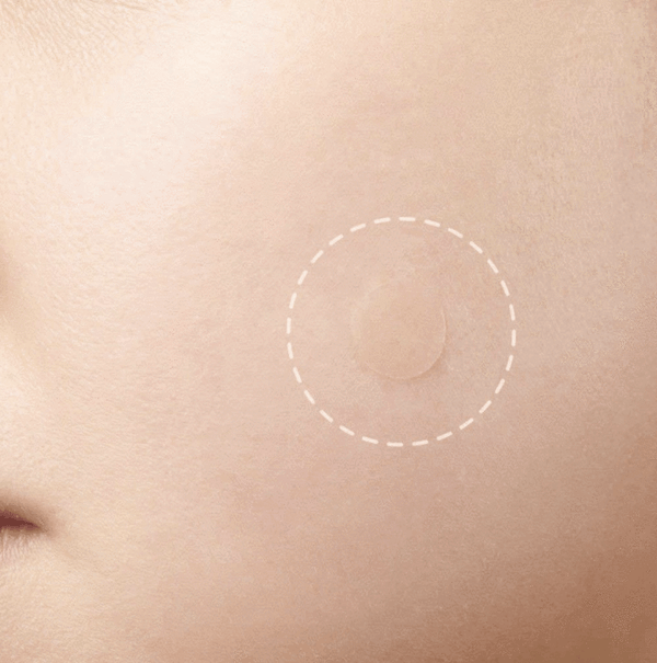 Skin Tag and Acne Patch